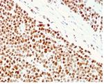 MSH6 (DNA Mismatch Repair Protein) Antibody in Immunohistochemistry (Paraffin) (IHC (P))