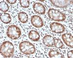 MSH6 (DNA Mismatch Repair Protein) Antibody in Immunohistochemistry (Paraffin) (IHC (P))