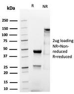 MSH6 (DNA Mismatch Repair Protein) Antibody in SDS-PAGE (SDS-PAGE)