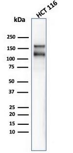 MSH6 (DNA Mismatch Repair Protein) Antibody in Western Blot (WB)