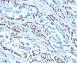 MSH6 (DNA Mismatch Repair Protein) Antibody in Immunohistochemistry (Paraffin) (IHC (P))