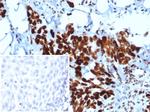 MSH6 (DNA Mismatch Repair Protein) Antibody in Immunohistochemistry (Paraffin) (IHC (P))