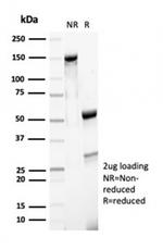 MSH6 (DNA Mismatch Repair Protein) Antibody in SDS-PAGE (SDS-PAGE)