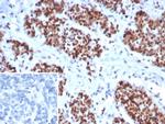 MSH6 (DNA Mismatch Repair Protein) Recombinant Rabbit Monoclonal Antibody (MSH6/8338R)