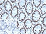MSH6 (DNA Mismatch Repair Protein) Antibody in Immunohistochemistry (Paraffin) (IHC (P))