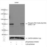 Phospho-PKC Delta (Ser359) Antibody in Western Blot (WB)