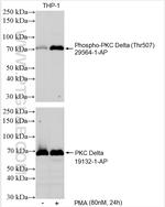 Phospho-PKC Delta (Thr507) Antibody in Western Blot (WB)