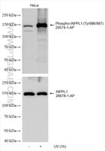 Phospho-INPPL1 (Tyr986, Tyr987) Antibody in Western Blot (WB)
