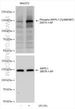 Phospho-INPPL1 (Tyr986, Tyr987) Antibody in Western Blot (WB)