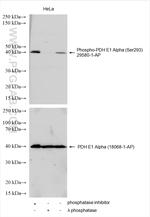 Phospho-PDH E1 Alpha (Ser293) Antibody in Western Blot (WB)