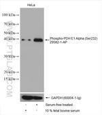 Phospho-PDH E1 Alpha (Ser232) Antibody in Western Blot (WB)