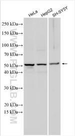 CXCL16 Antibody in Western Blot (WB)
