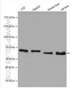 PDIA5 Antibody in Western Blot (WB)