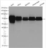 NUMB Antibody in Western Blot (WB)