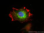 LAMTOR1 Antibody in Immunocytochemistry (ICC/IF)