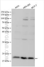 LAMTOR1 Antibody in Western Blot (WB)