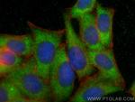HTRA1 Antibody in Immunocytochemistry (ICC/IF)
