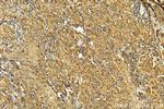 HTRA1 Antibody in Immunohistochemistry (Paraffin) (IHC (P))
