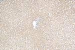 NDUFA9 Antibody in Immunohistochemistry (Paraffin) (IHC (P))