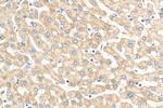 NDUFA9 Antibody in Immunohistochemistry (Paraffin) (IHC (P))