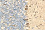 OTUD3 Antibody in Immunohistochemistry (Paraffin) (IHC (P))