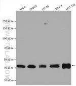 OTUD3 Antibody in Western Blot (WB)