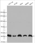 OTUD3 Antibody in Western Blot (WB)