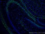 SRGAP3 Antibody in Immunohistochemistry (Paraffin) (IHC (P))