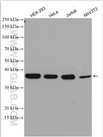 TRA2B Antibody in Western Blot (WB)