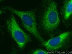 UBAP2 Antibody in Immunocytochemistry (ICC/IF)