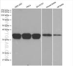 PPT1 Antibody in Western Blot (WB)