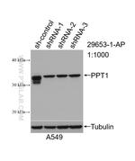 PPT1 Antibody in Western Blot (WB)
