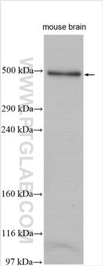 FRAS1 Antibody in Western Blot (WB)