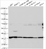 Phospho-VPS34 (Thr159) Antibody in Western Blot (WB)