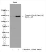 Phospho-PLCG1 (Ser1248) Antibody in Western Blot (WB)