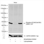 Phospho-ATG4B (Ser383) Antibody in Western Blot (WB)