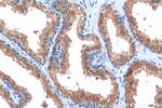 PGM3 Antibody in Immunohistochemistry (Paraffin) (IHC (P))