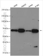 PGM3 Antibody in Western Blot (WB)