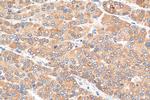 GGPS1 Antibody in Immunohistochemistry (Paraffin) (IHC (P))