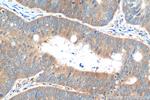 EIF4E Antibody in Immunohistochemistry (Paraffin) (IHC (P))