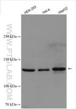 DHX37 Antibody in Western Blot (WB)