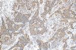 BIRC6 Antibody in Immunohistochemistry (Paraffin) (IHC (P))