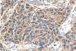 BIRC6 Antibody in Immunohistochemistry (Paraffin) (IHC (P))