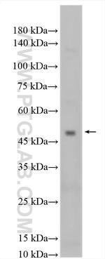 KCNK12 Antibody in Western Blot (WB)