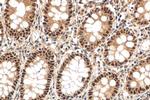 POLD2 Antibody in Immunohistochemistry (Paraffin) (IHC (P))