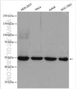 POLD2 Antibody in Western Blot (WB)