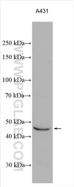 SCPEP1 Antibody in Western Blot (WB)