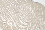 KANK1 Antibody in Immunohistochemistry (Paraffin) (IHC (P))