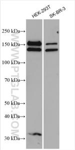 KANK1 Antibody in Western Blot (WB)