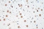 CHD8 Antibody in Immunohistochemistry (Paraffin) (IHC (P))